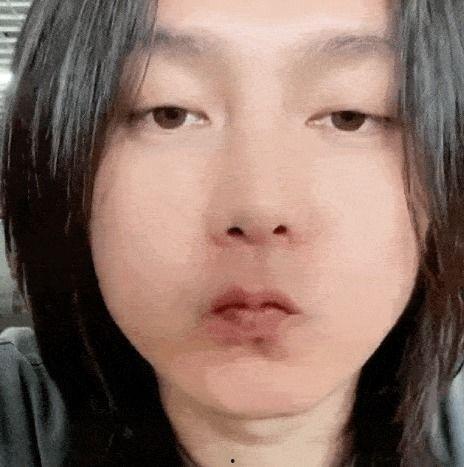得痛风的明星